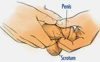 Dry Skin Around Penis 34