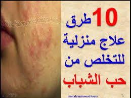 علاج حب الشباب في يوم واحد جرب وأحكم بنفسك Acne Scars Youtube