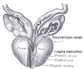 Prostatită în nisip în rinichi
