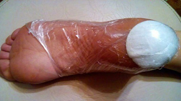 CARA AMPUH MENGHILANGKAN KAKI KERING DAN PECAH-PECAH DENGAN BOLA KAPAS CARA AMPUH MENGHILANGKAN KAKI KERING DAN PECAH-PECAH DENGAN BOLA KAPAS