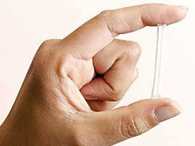 El anticonceptivo subdérmico se pone de moda