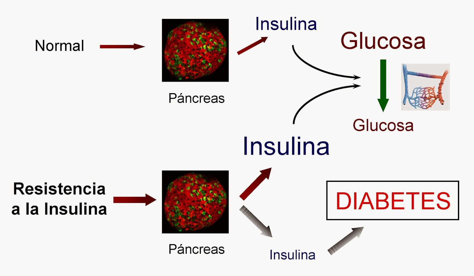 hormona insulina y diabetes dieta