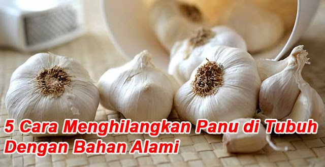 Cara Menghilangkan Panu di Tubuh dengan Bahan Alami 5 Cara Menghilangkan Panu di Tubuh dengan Bahan Alami
