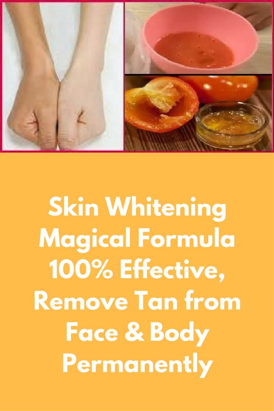 Skin Whitening Magical Formula 100 Effective, Remove Tan From Face