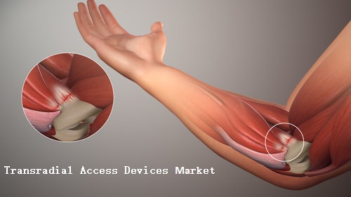 Transradial Access Devices Market