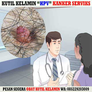 Obat Kutil Kelamin