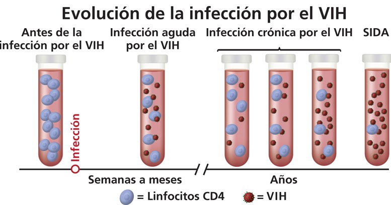 Detengamos el VIH: ¿Cuáles son los síntomas de infección por el VIH/SIDA?