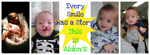 Every Smile Has a Story: This is Aiden's