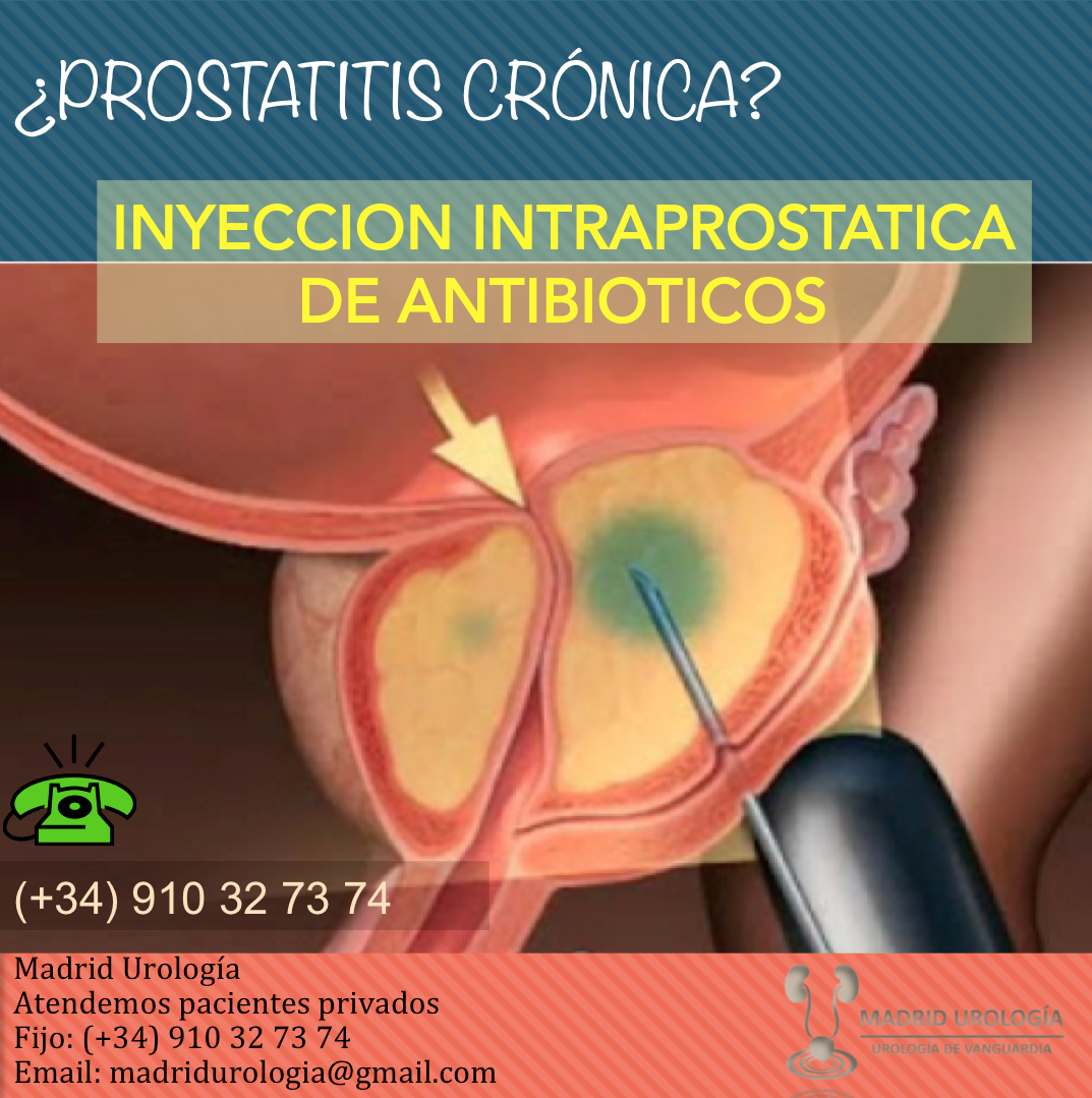 prostatitis cronica tratamiento quirurgico