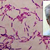 Mad Scientist Injects Himself A 3.5 Million-Year-Old Permafrost Bacteria. The Results Are Shocking!