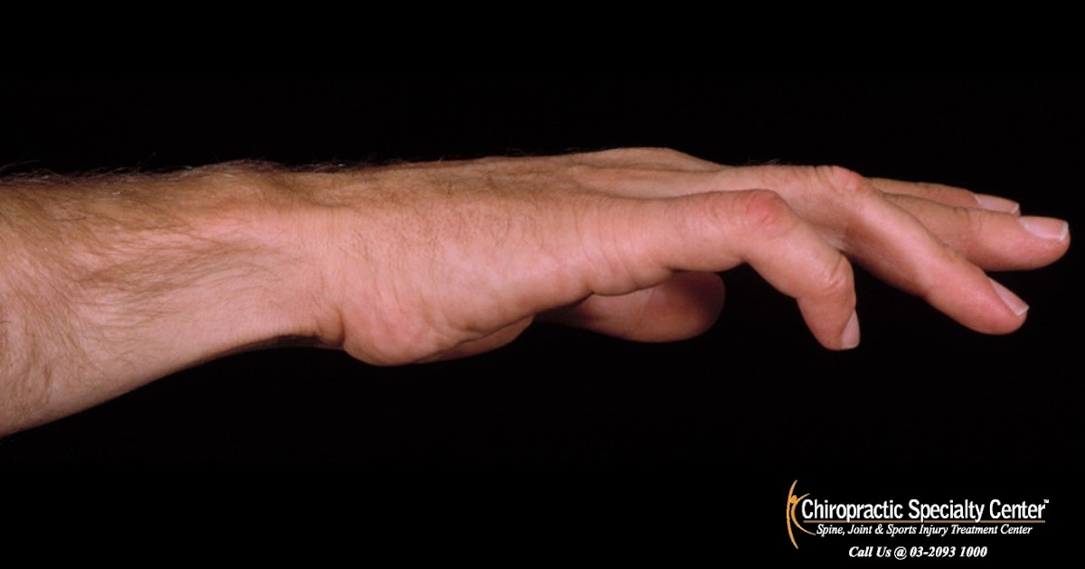 Best treatment for Ulnar nerve compression or injury