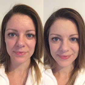bareMinerals blemish remedy foundation before and after