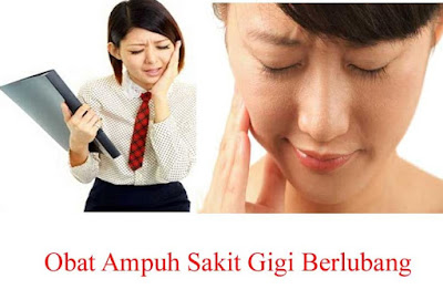 Obat Ampuh Sakit Gigi Berlubang Dan Cara Mengobatinya
