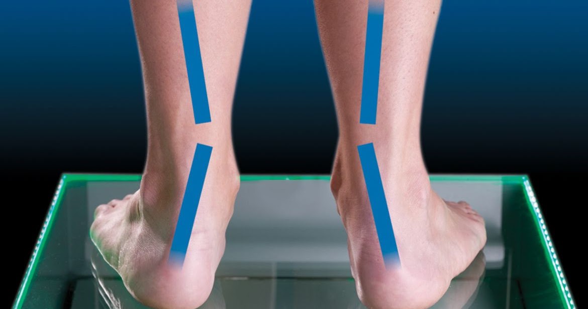 shoes that help with overpronation