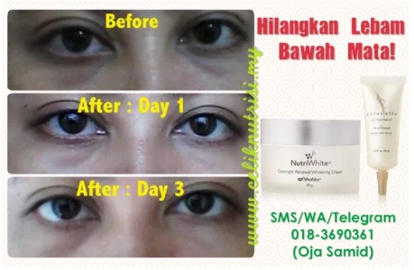 Ziana Eunos: Petua hilangkan lingkaran hitam atau eye bag