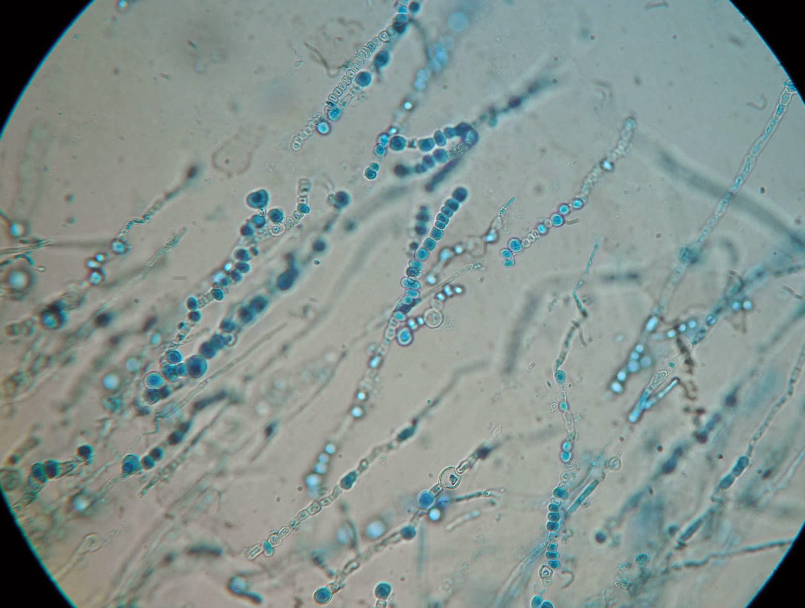 На коже обнаружены споры. Микроскопия Trichophyton rubrum. Микроскопия Trichophyton verrucosum.