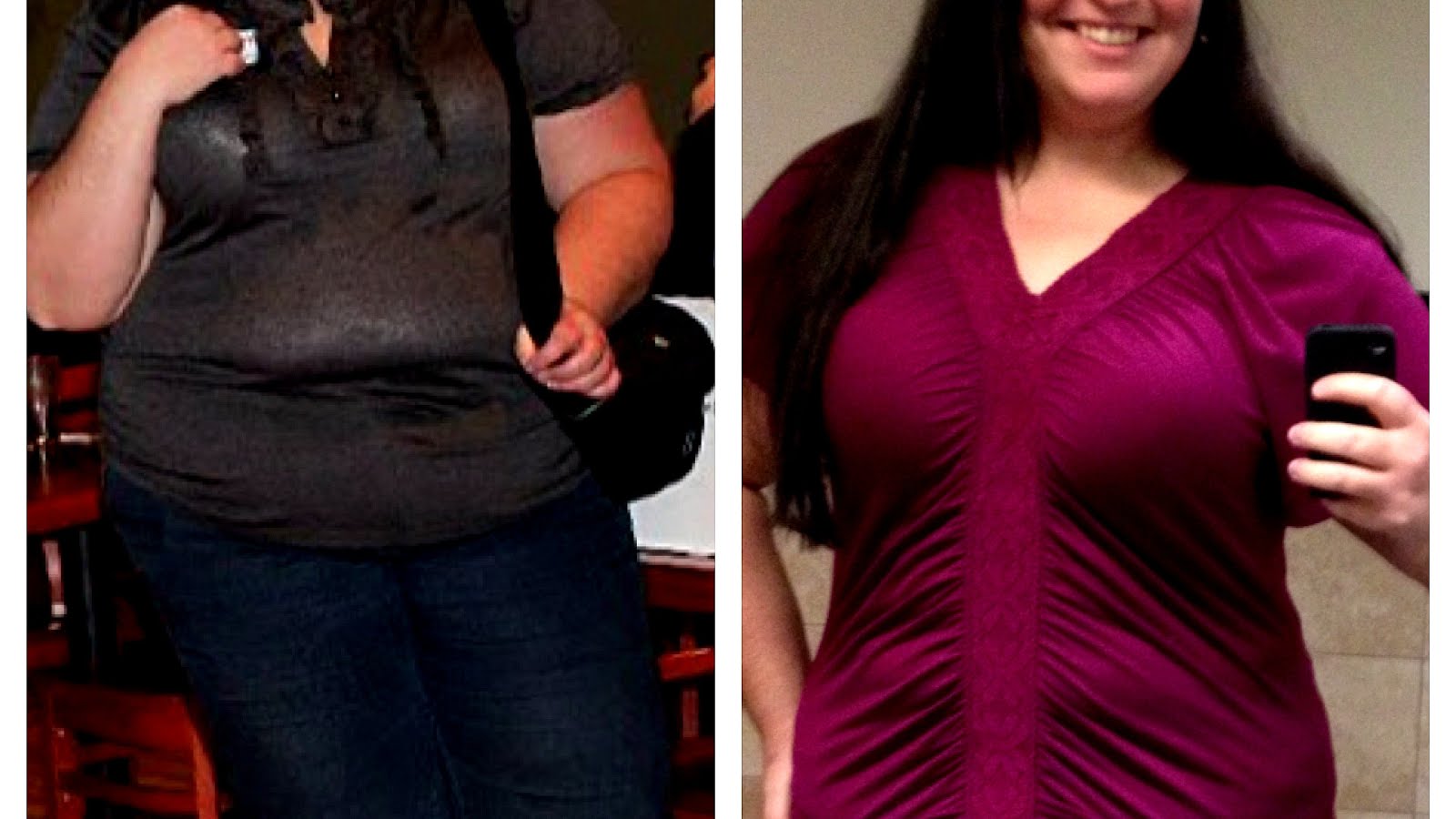 Side Effects Of Bypass Surgery Effect Choices