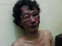 Bah !!! Lumbantobing Ditebas Di Lapo Tuak, Malah Kawanya Yang Tewas Bersimbah Darah Bah !!! Lumbantobing Ditebas Di Lapo Tuak, Malah Kawanya Yang Tewas Bersimbah Darah