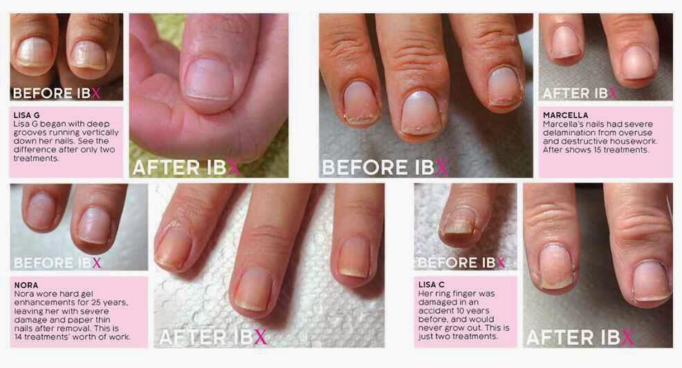 Gel Nail Polish Damage