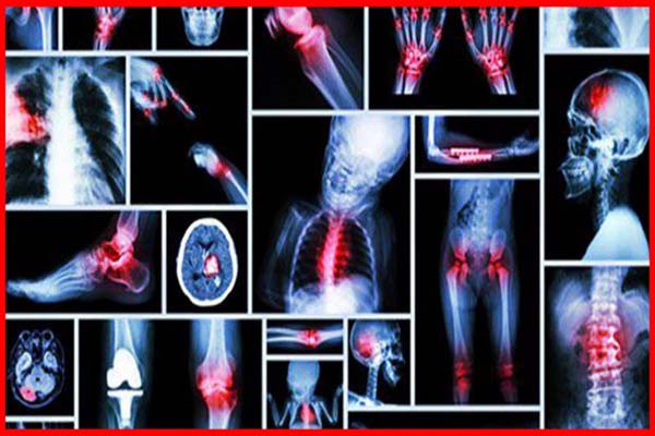 مشاعركم المكبوتة تؤدي إلى إصابتكم بهذه الأمراض…