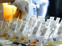 6 Cara Mengeluarkan Racun Melalui Urine dengan Bahan Alami