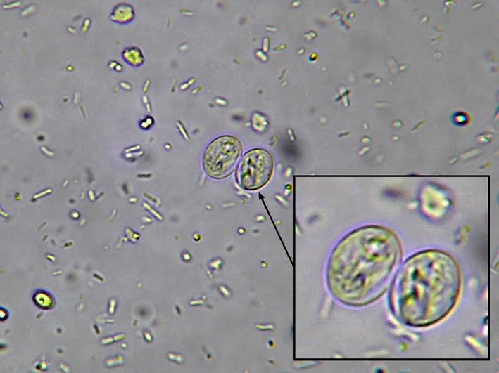 giardia cysts in stool images