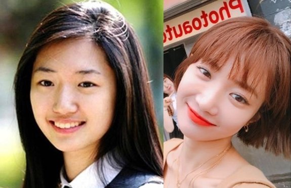 Goo Jun Hee dulu dan sekarang
