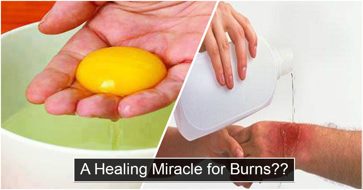 EGG WHITE A Healing Miracle For Burns? NEWS INFO PHILIPPINES
