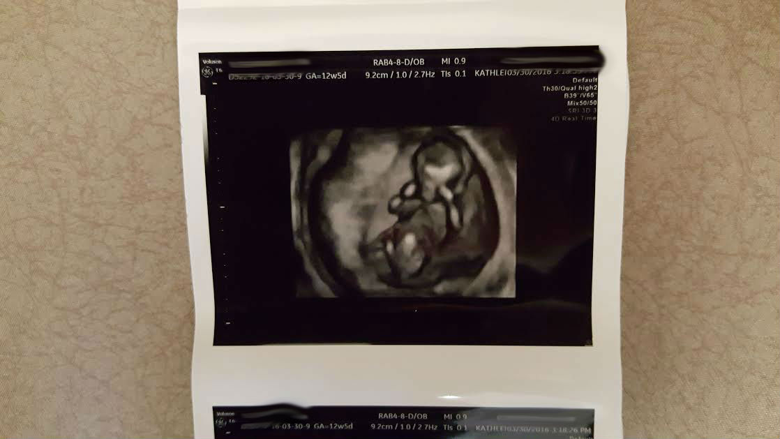 Hominy Girl Pregnancy Journal The Beginning