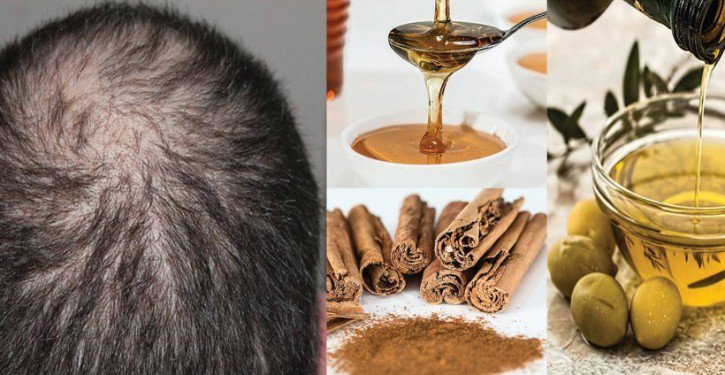 إليك ما قامت به هذه السيدة لتطويل الشعر بعدما كانت صلعاء!