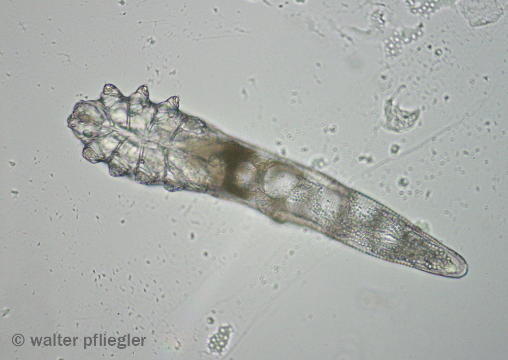 How Humans Get Demodex