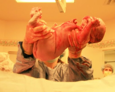 Asuhan Kebidanan Pada Bayi Baru Lahir Fisiologis