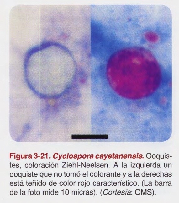 Cyclospora spp