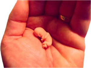 Image: Life size model of baby at 8 weeks after conception. Photo credit: Bill Davenport (lumix2004) on Free Images