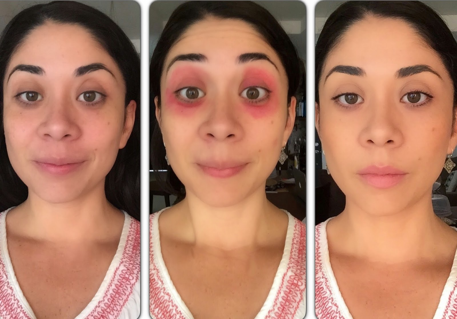 Makeup Madness New Trend Red Lipstick as Concealer