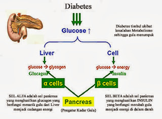 Pengertian Dan Penyebab Diabetes Melitus | HEMODIALYSIS Pengertian Dan