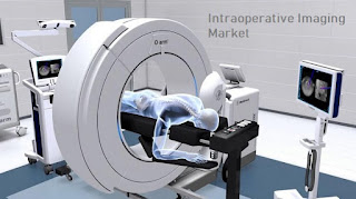Intraoperative Imaging Market Intraoperative Imaging Market