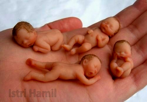 susu untuk bayi prematur susu untuk bayi prematur