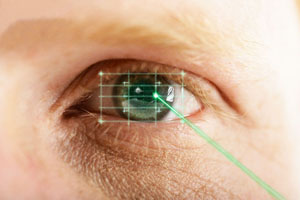 laserul afectează vederea