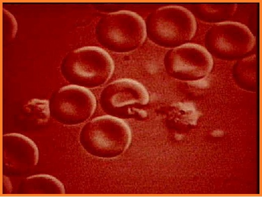 Malária plazmodium különbségek Vérfázisú paraziták. A férgek és az élősködő tabletták megelőzése