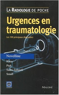 Urgences en traumatologie : Les 100 principaux diagnostics 41ADZ20TJTL._SX305_BO1%252C204%252C203%252C200_