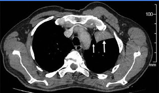 Deepu joseph thesis 05 picture