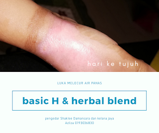 Testimoni Basic H Dan Herbal Blend shaklee