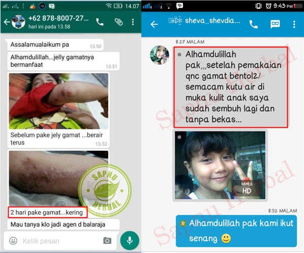 Cara Mengobati Bintik Merah Dan Gatal Pada Alat Kelamin Sampai Sembuh Total Cara Mengobati Bintik Merah Dan Gatal Pada Alat Kelamin Sampai Sembuh Total