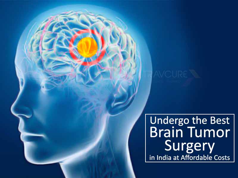Undergo the Best Brain Tumor Surgery in India at Affordable Costs