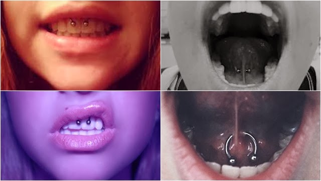 Termino de namoro por telefone