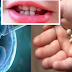 Don’t Throw Away Baby's Teeth; It Can Save Your Child’s Life