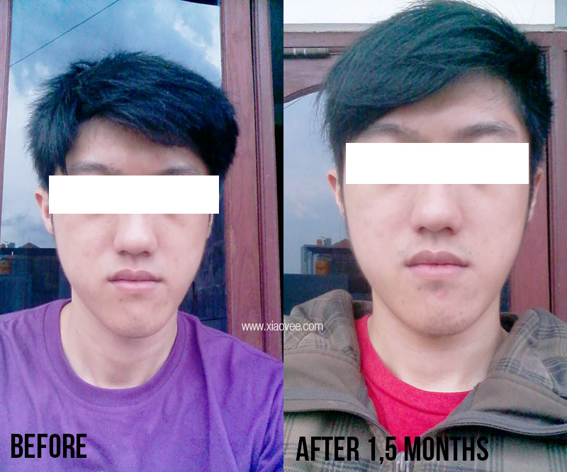 Xiao Vee Indonesian Beauty Blogger KOJIE•SAN Skin Lightening Series