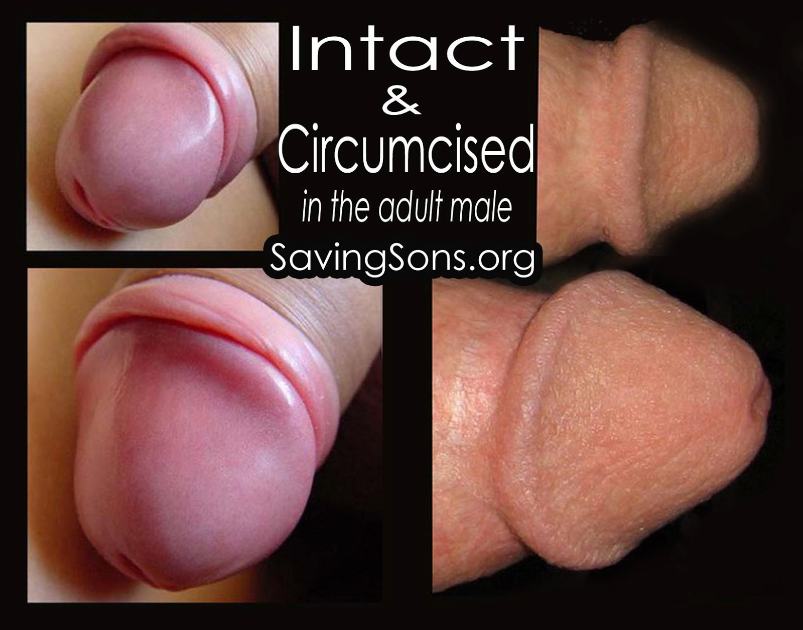 Women prefer uncircumcised