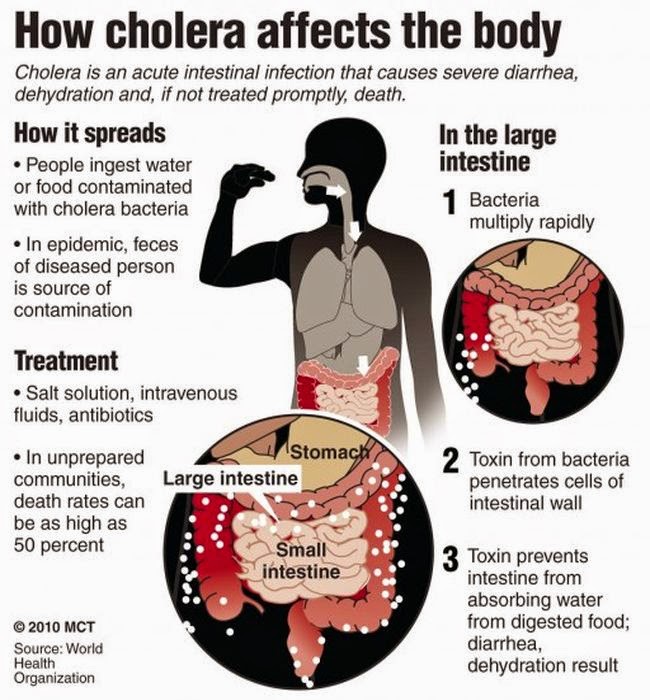 Home Remedies And Treatments for Cholera Medi Tricks
